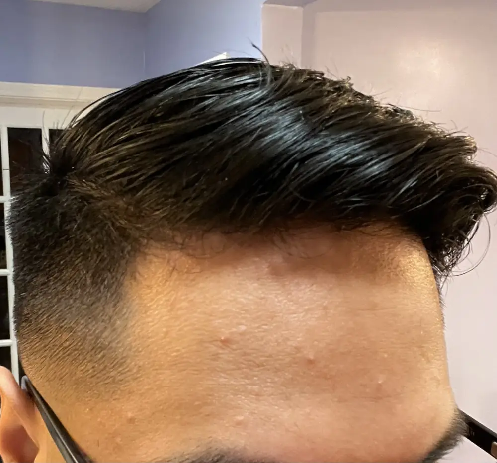 Textured top with a sharp taper